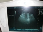 Emma__s_Ultrasound_005.jpg